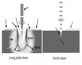 What is nanosecond, picosecond and femtosecond lasers?